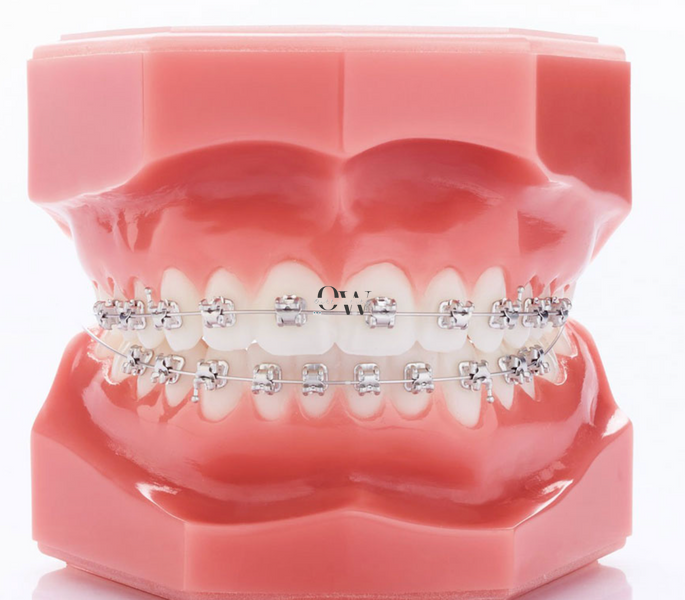 Брекети EXPERIENCE Metal Rhodium GC Orthodont&iacute;cs верхня щелепа 1exp_rh_2 фото